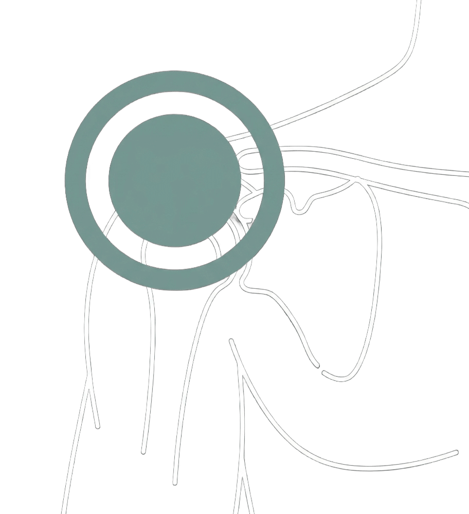 douleur épaule et tendinite traitement pour douleur à l'épaule, tendinite de l'épaule ou bursite de l'épaule à Beauport
